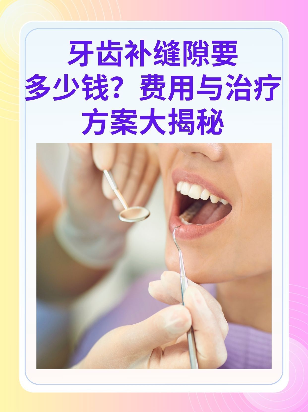 珠海补牙医保可以报销吗(补牙医保可以报销吗 哪些可以报销呢)